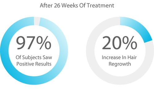 Laser hair growth