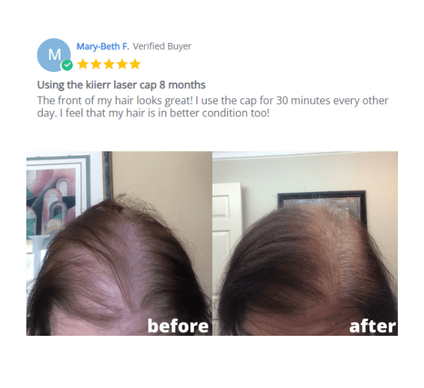 5 Best Laser Hair Growth Caps Review Ultimate Guide